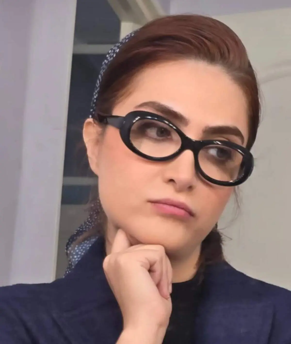 الناز ملک سیمای زخم کاری با چهره و استایل جذاب/ عکس
