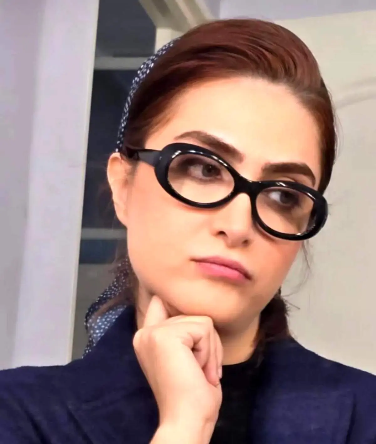 الناز ملک سیمای زخم کاری با چهره و استایل جذاب/ عکس