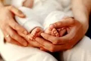 نوزاد وحشتناکی که سه چشم دارد+ عکس