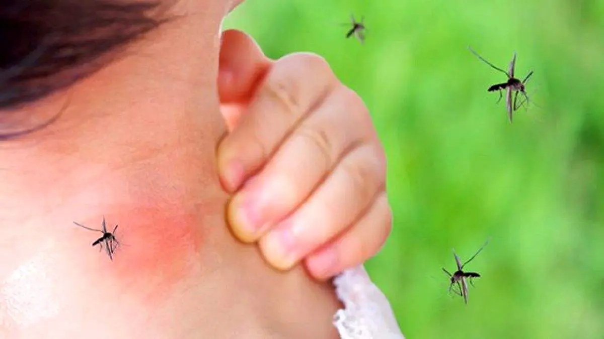 آشنایی با عوارض خطرناک خاراندن محل نیش پشه