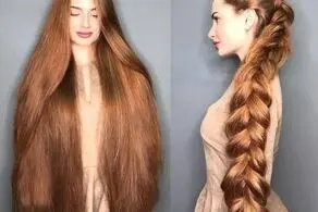 موهای دو متری این دختر جوان بعد 5 سال ریزش مو و کچلی!+عکس