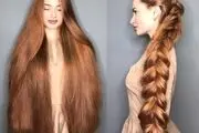 موهای دو متری این دختر جوان بعد 5 سال ریزش مو و کچلی!+عکس