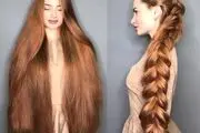 موهای دو متری این دختر جوان بعد 5 سال ریزش مو و کچلی!+عکس