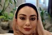  تغییر چهره یکتا ناصر که باور نمی کنید/ عکس