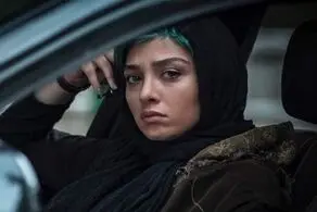 آناهیتا درگاهی بعد از عمل زیبایی/ عکس