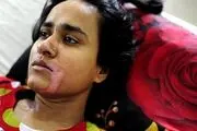 بلای دردناکی که پدرشوهر سنگدل بر سر عروس بیچاره‌اش آورد +عکس