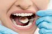 این علامت در دهان نشانه ابتلا به دیابت است
