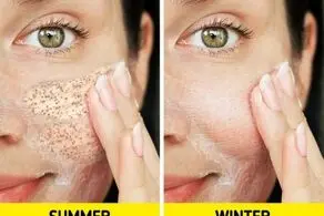  عادت های صبحگاهی که دشمن پوست است!
