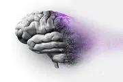 تصویری ترسناک و بسیار عجیب از مغز یک آلزایمری در برابر مغز سالم/ عکس