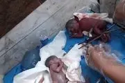 این زن25 ساله 7 قلو زاید!+ عکس
