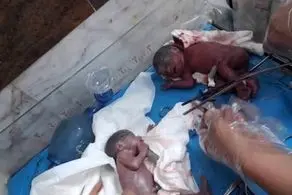 این زن25 ساله 7 قلو زاید!+ عکس