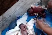 این زن25 ساله 7 قلو زاید!+ عکس