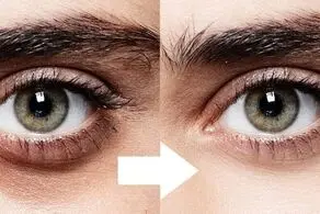 این بچه به عنوان دارنده زیباترین چشمان جهان انتخاب شد/ عکس