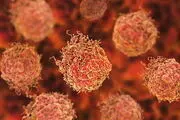 این بیماری دومین علت مرگ در ایران است