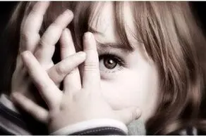 یک حیوان ترسناک با صورت انسان به دنیا آمد/ عکس