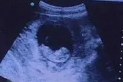 حضور شیطان داخل رحم این زن! + عکس