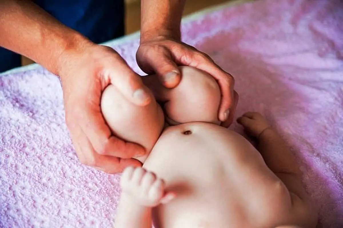 عکس/  هشدار، اگر دلش را ندارید عکس این نوزادعجیب الخلقه را نبینید