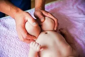 عکس/  هشدار، اگر دلش را ندارید عکس این نوزادعجیب الخلقه را نبینید