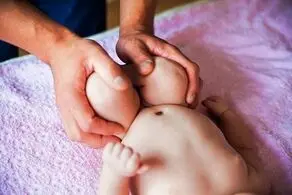 عکس/  هشدار، اگر دلش را ندارید عکس این نوزادعجیب الخلقه را نبینید
