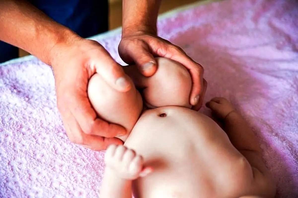 عکس/  هشدار، اگر دلش را ندارید عکس این نوزادعجیب الخلقه را نبینید