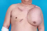 رشد کردن یک صورت جدید بر روی سینه این مرد/عکس +18