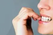 این گیاه تیک عصبی را به راحتی درمان می کند