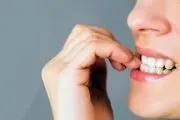 این گیاه تیک عصبی را به راحتی درمان می کند