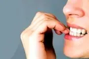 این گیاه تیک عصبی را به راحتی درمان می کند