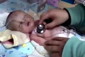 سگ ولگرد نوزاد زنده به گور شده را پیدا کرد+عکس