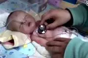 سگ ولگرد نوزاد زنده به گور شده را پیدا کرد+عکس