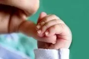 فقر آهن در کودکان چه علایمی دارد؟