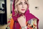 نیوشا ضیغمی را بعد از این عمل های زیبایی نمی شناسید/ عکس