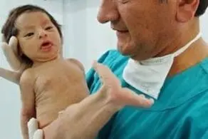 کشتن دلخراش نوزادی که شبیه پری دریایی بود!+عکس