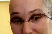 نصف شدن هولناک صورت زن بیچاره با مته برقی! + عکس