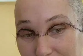 نصف شدن هولناک صورت زن بیچاره با مته برقی! + عکس