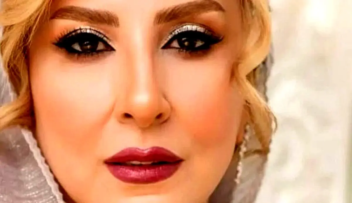  مرجانه گلچین بعد از تزریق های زیبایی هنگام انتخاب لباس عروس/ عکس