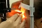 لانه چندش آور شپش در چشم بچه 5 ساله + عکس