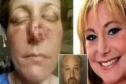 مردی دیوانه با گاز صورت نامزد سابقش بی‌ریخت کرد! + عکس