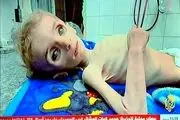 تصاویر وحشتناک از غزه که قلب را به درد می‌آورد + ببینید 