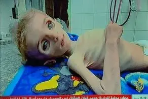 تصاویر وحشتناک از غزه که قلب را به درد می‌آورد + ببینید 