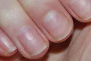 موجو وحشتناکی که زیر ناخن شما زندگی می کند/ ویدئو