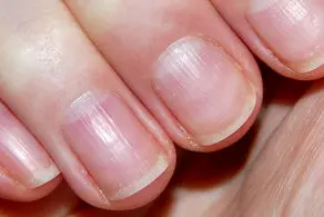 ناخن های ترسناک 36 سانتی یک زن 54 ساله+ عکس