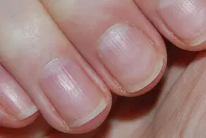 موجو وحشتناکی که زیر ناخن شما زندگی می کند/ ویدئو