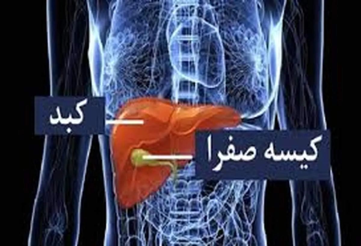 هشدار جدی؛ این غذاها باعث تحریک کیسه صفرا می شوند
