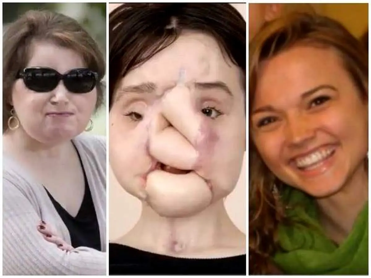 پیوند اعضای متلاشی شده دختر جوان + عکس