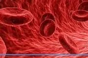 8  نشانه کمبود آهن در بدن