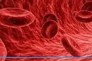 8  نشانه کمبود آهن در بدن