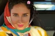 الناز شاکردوست هم کوبید و چهره ای از نو ساخت!/ عکس