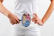 تاثیر عجیب میکروب های روده بر شدت سکته مغزی 