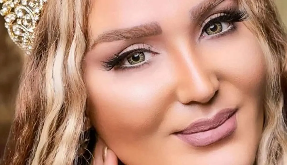 عمل‌های جراحی متعدد این بلا را بر سر بازیگر زن معروف سینمای ایران آورد!+ عکس باورنکردنی
